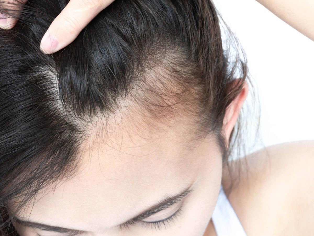 baby hair