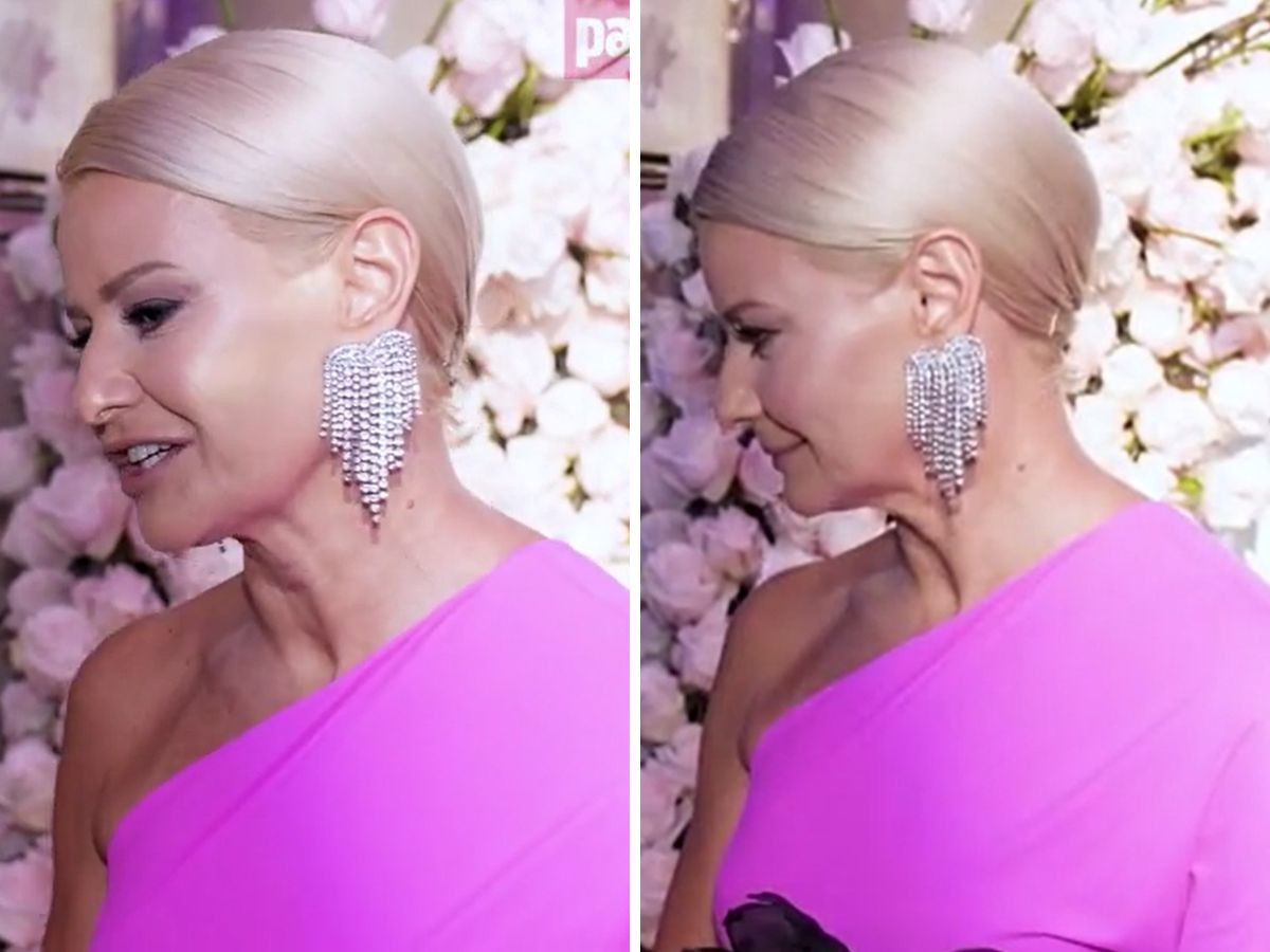 Małgorzata Kożuchowska o medycynie estetycznej