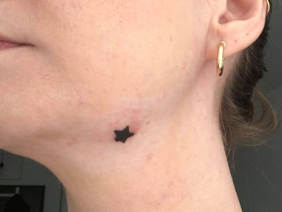 punktowa gwiazdka przeciw wypryskom