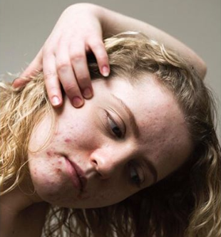 twarz z tradzikiem, portret w projekcie epidermis