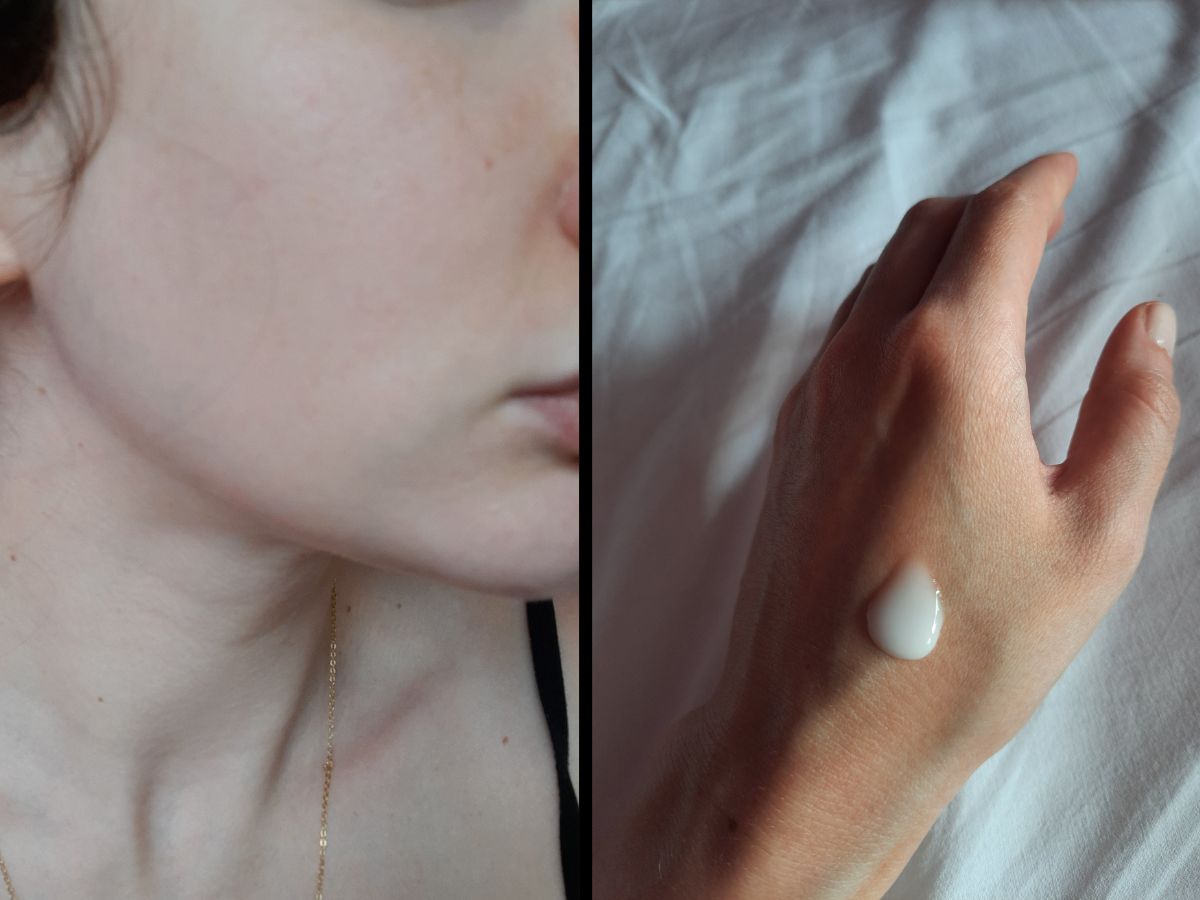 Serum z 4x kwasem hialuronowym w 28 dni działa na moją skórę jak kilka sesji masażu kobido. Zmarszczki znikają jakby je ktoś wypełnił