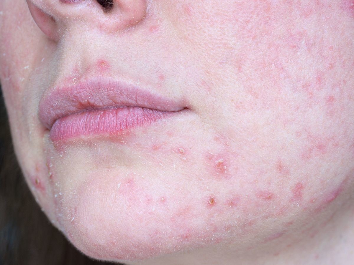 Peeling enzymatyczny Clean Shot Eveline nowość