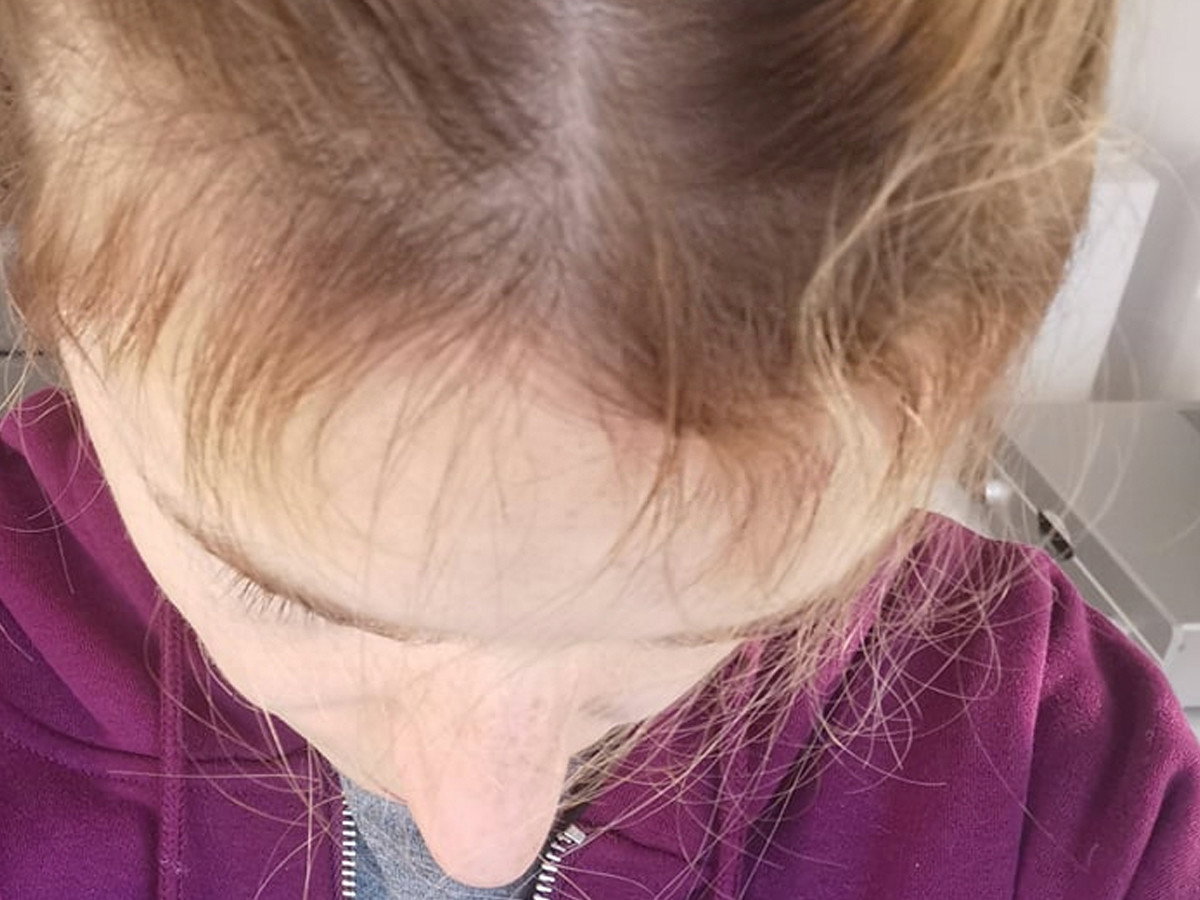 Baby hair