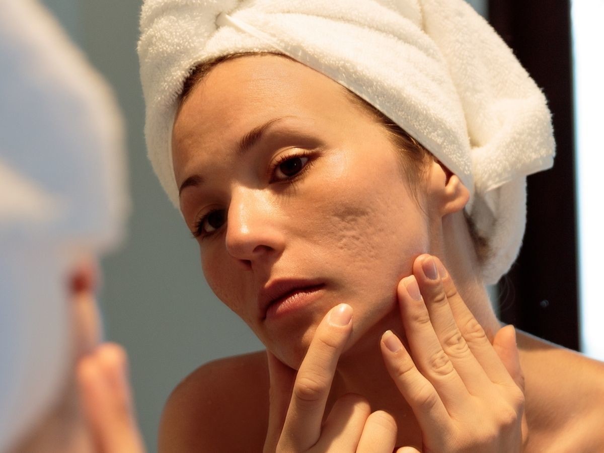 Ta tania wcierka do skóry głowy to hit! „Widzę piękny wysyp baby hair”, włosy rosną zdrowe i mocne