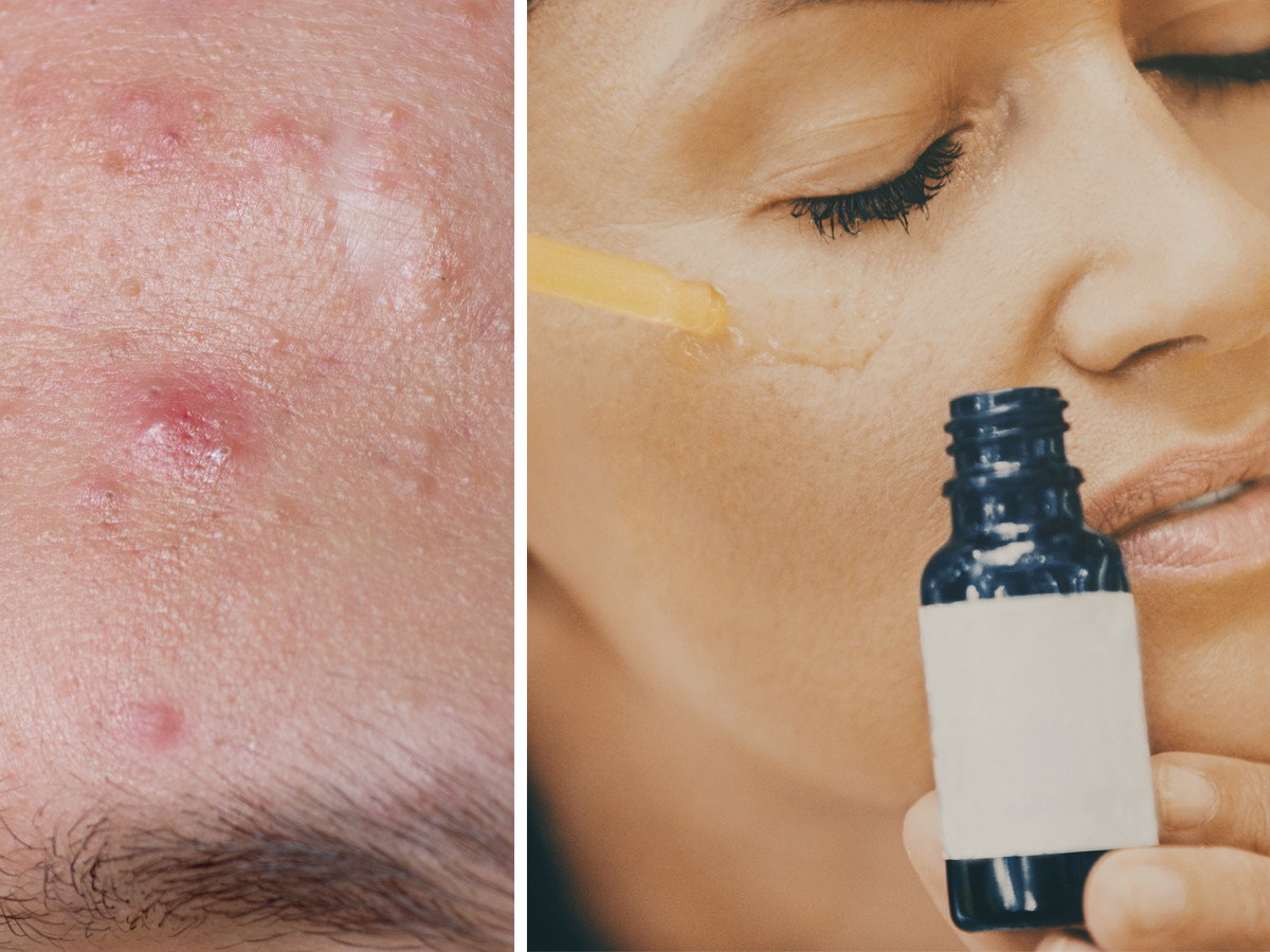 Serum z kwasem niacynoamidowym od Revox Just Niacinamide