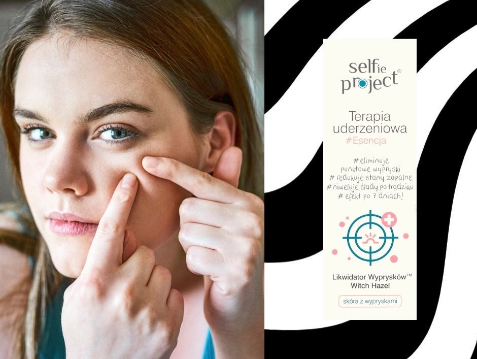 serum-na-wypryski-terapia-uderzeniowa-selfie-project