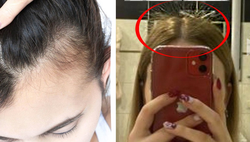 „Dała mi największy wysyp baby hair”. Ta ajurwedyjska wcierka zagęszcza włosy w 5 tygodni. To game changer