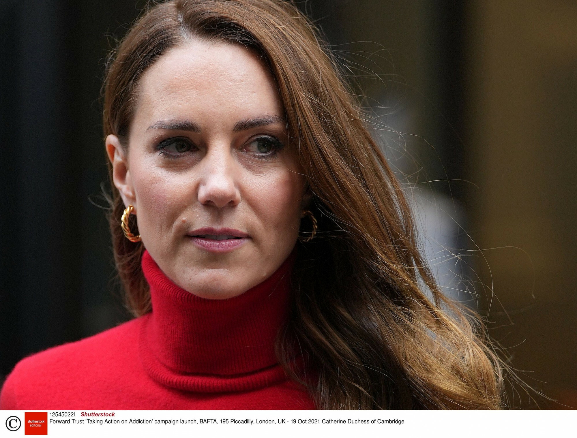 W mediach pojawiło się zdjęcie "pobitej" księżnej Kate. "Zgłosiła go, ale nikt jej nie uwierzył".  Royalsi w szoku