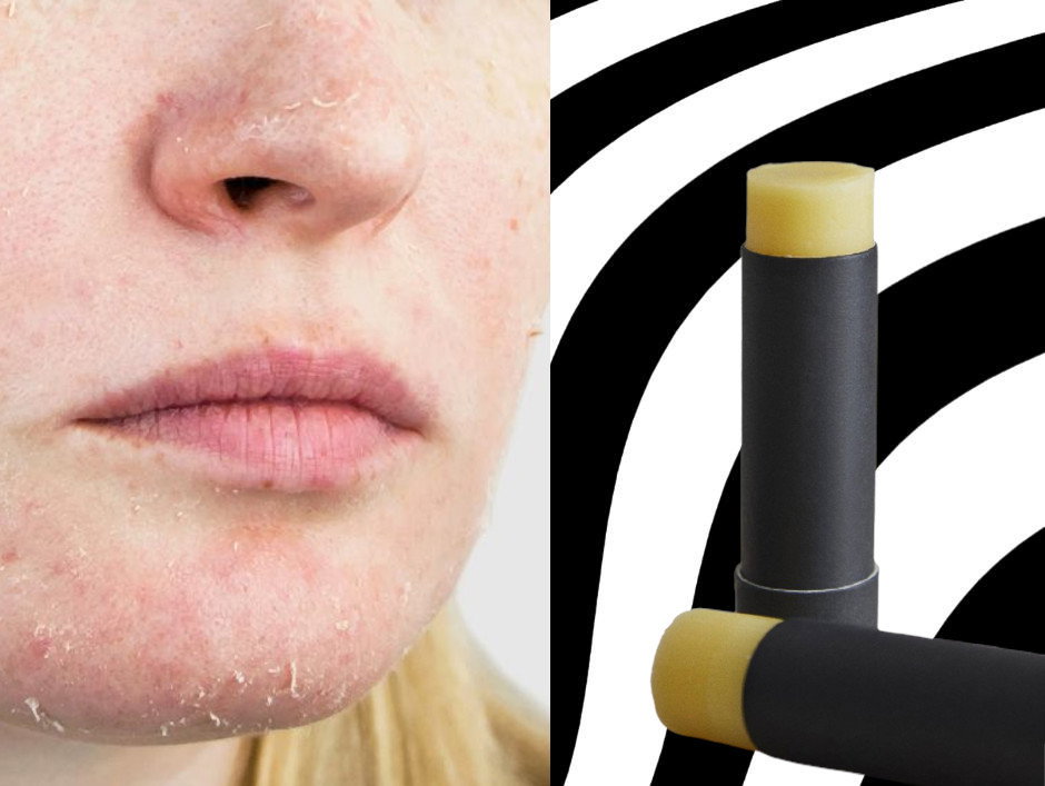podrażniona, sucha skóra - sztyft do twarzy ala beauty