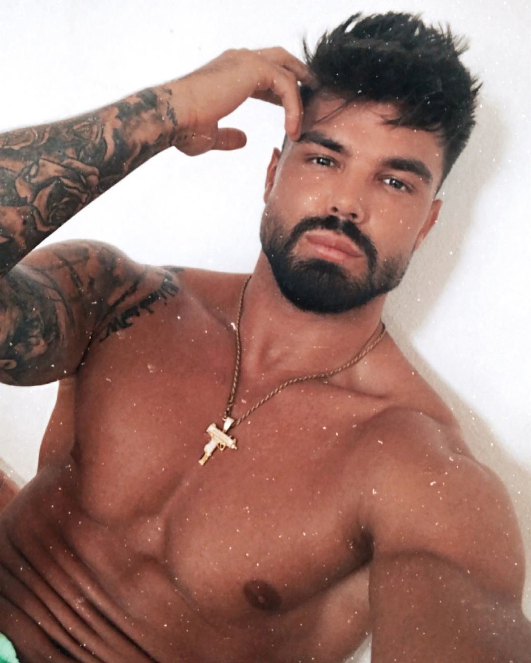 Paweł z "Love Island" padł ofiarą zabiegu medycyny estetycznej