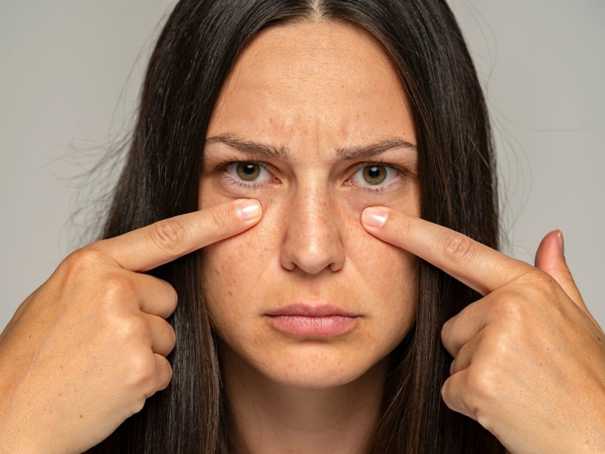 Profesjonalne serum pod oczy działa jak lifting i unosi opadająca powiekę! „Zmarszczki są zdecydowanie płytsze”