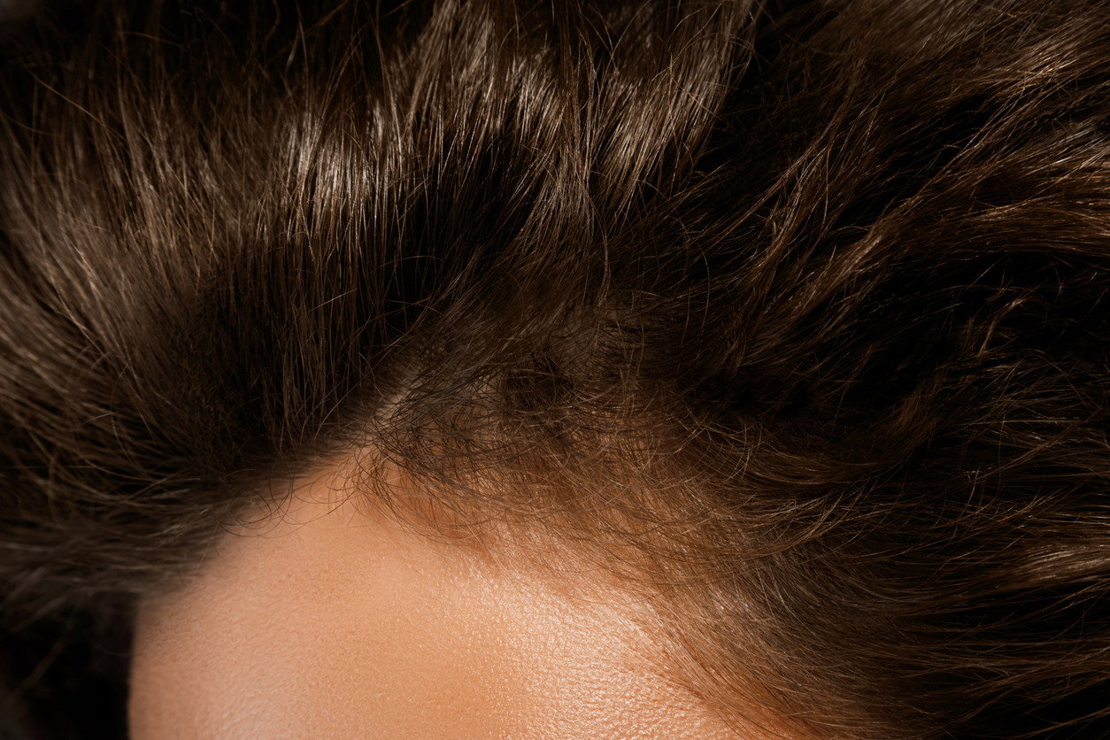 gęste włosy z widocznymi baby hair