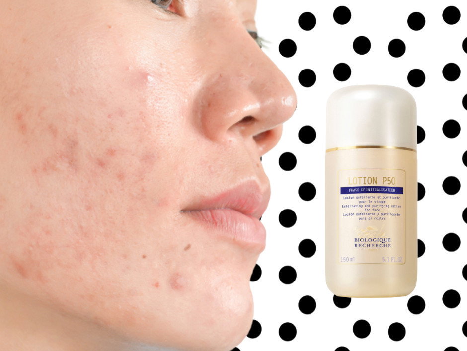 cera trądzikowa - Biologique Recherche, Lotion P50