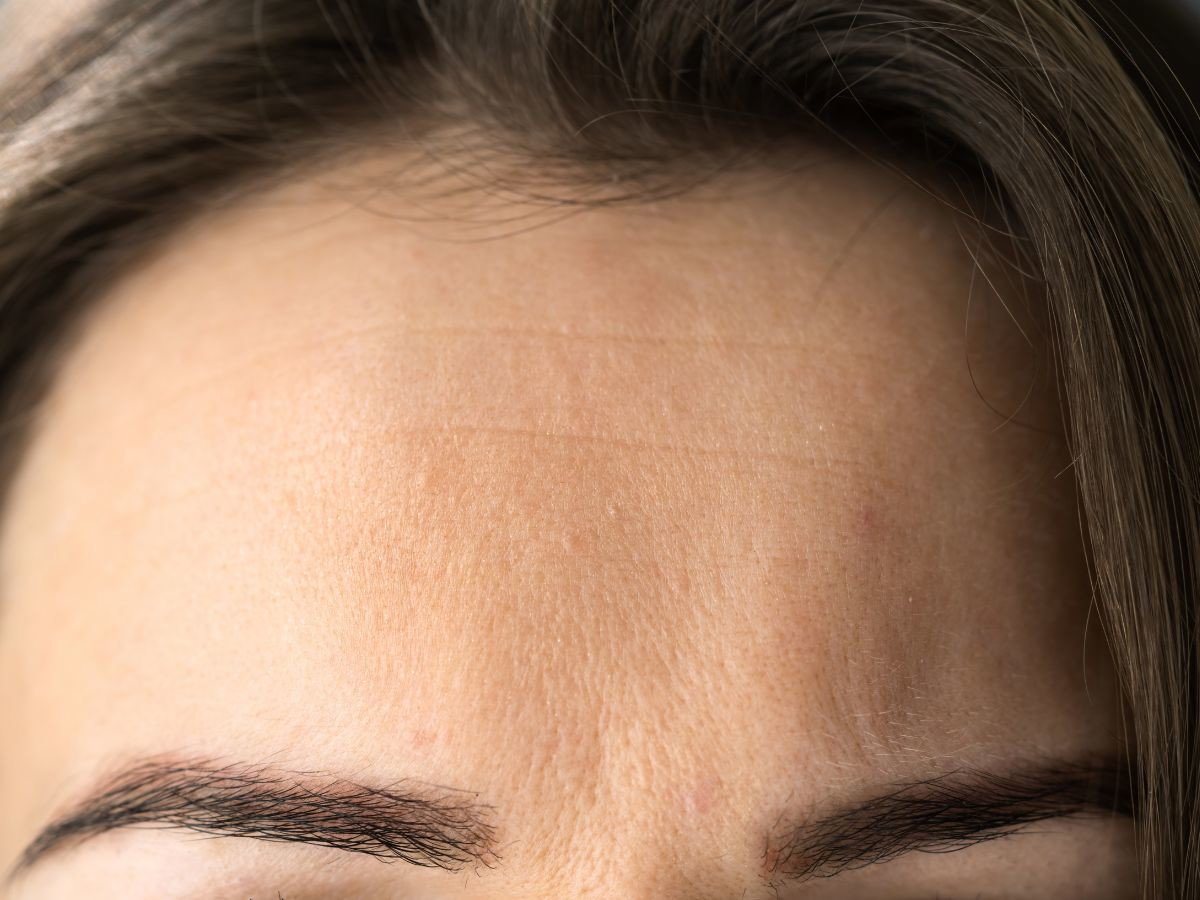 kultowe serum Anti-Age wypełnia zmarszczki na czole i liftinguje skórę jak laseroterapia za 1300 zł. Jest własnie na promocji -50%
