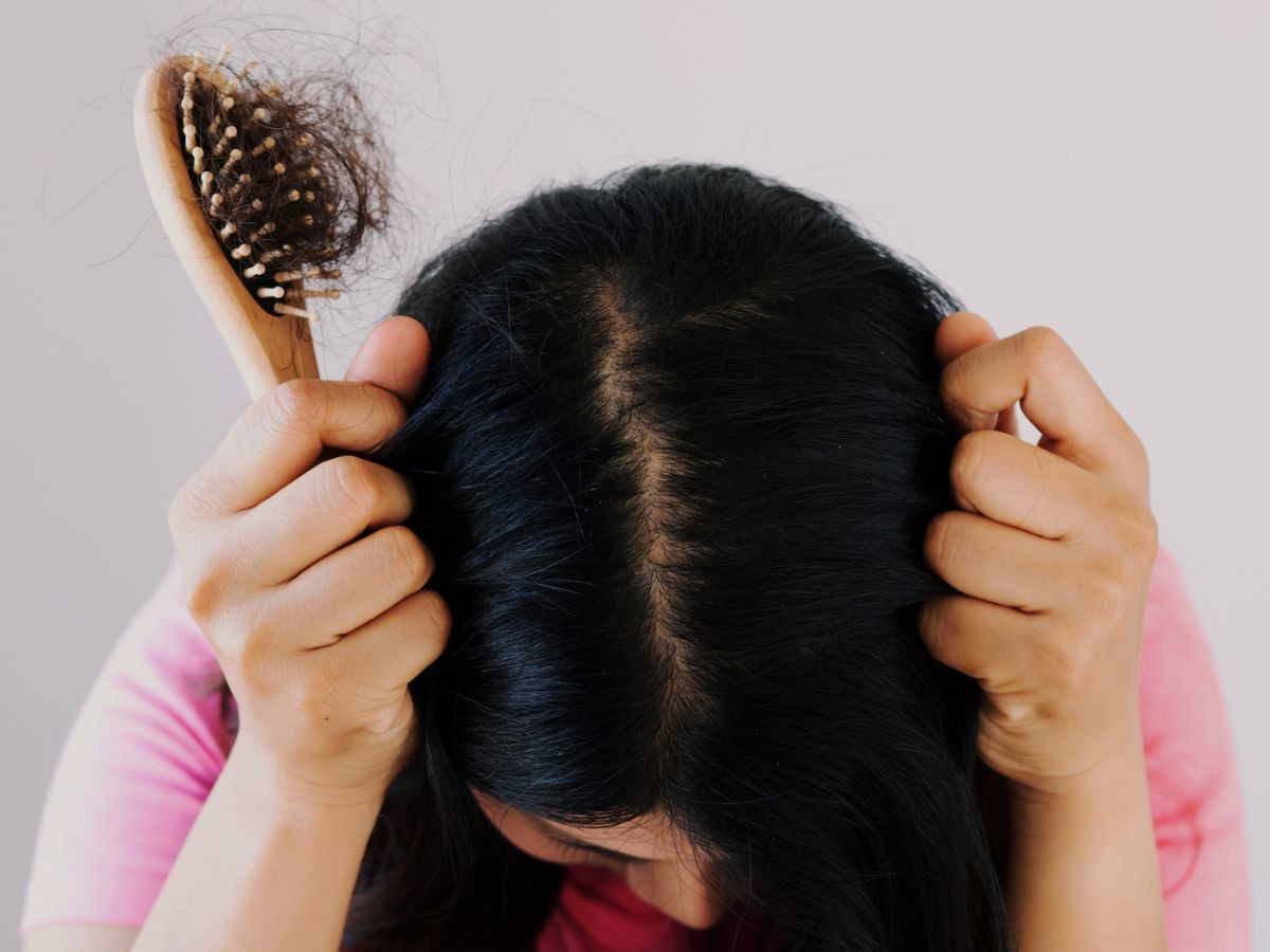 Ta kuracja stymulująca wzrost włosów z apteki to hit z promocji! „Zakola mniej widoczne, pojawiło się mnóstwo babyhair”.
