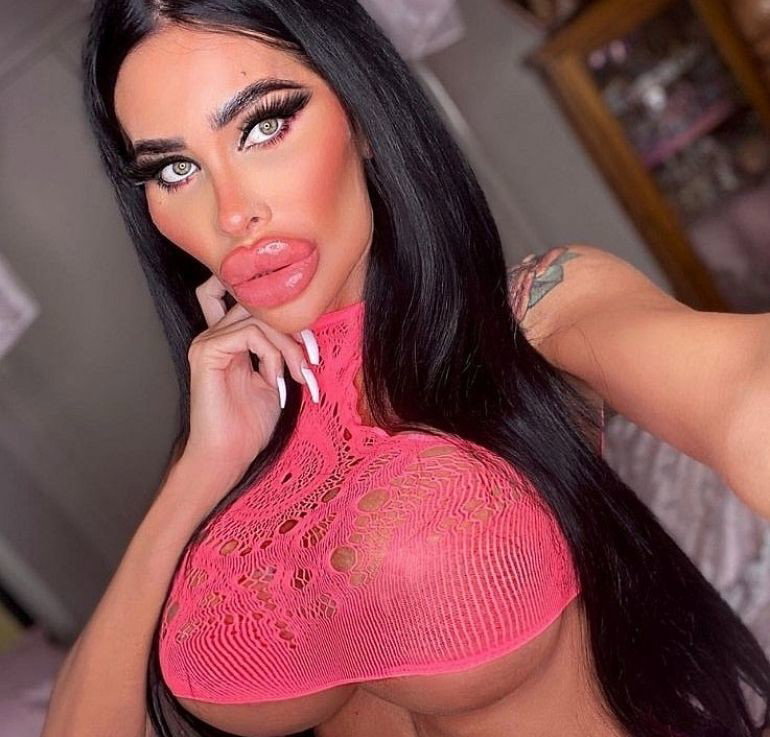 Tara Jayne McConachy jest uzależniona od operacji plastycznych