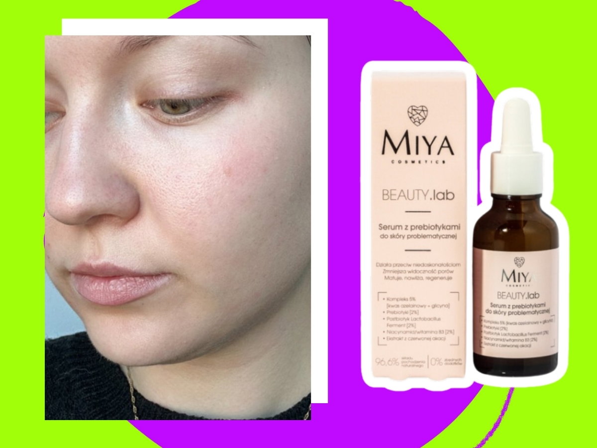 Serum z prebiotykami do skóry problematycznej, MIYA