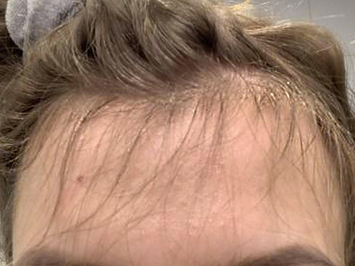 Wcierka do włosów, baby hair, działanie