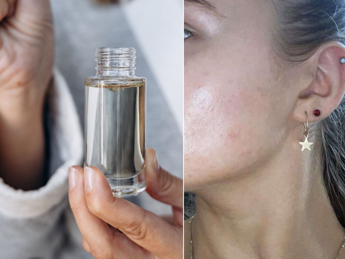 Viralowe serum z 10% niacynamidem