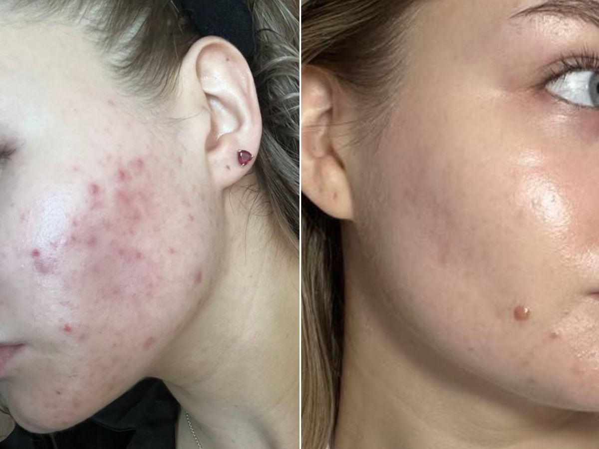 Słowiańskie serum z kapsułkowaną arbutyną
