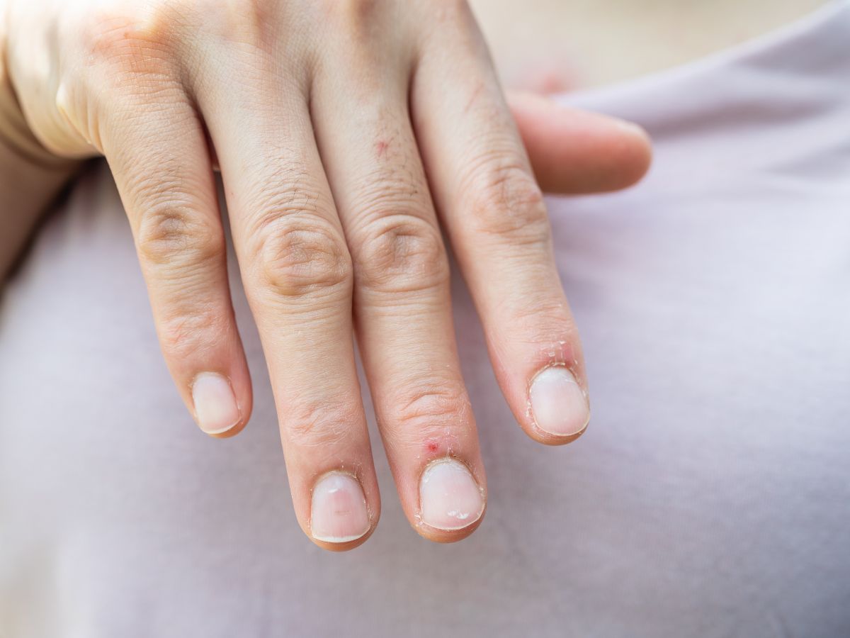 Nail slugging