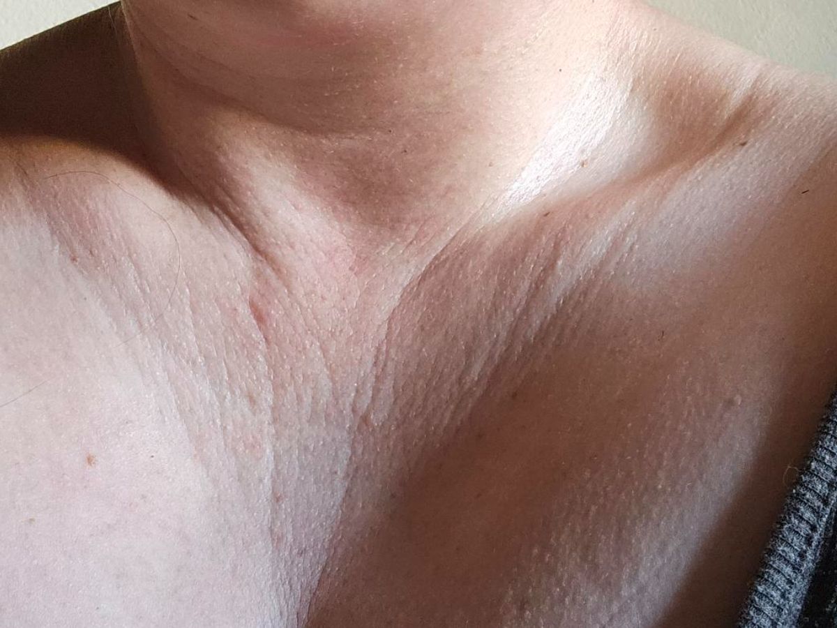 To mój tani sposób na bruzdy marionetkowe 40+ i senne zmarszczki na dekolcie. Sekretem są 3 składniki