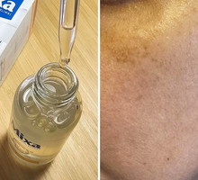serum na przebarwienia na twarzy Mixa CG GA