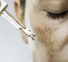 Dermatolodzy mają faworyta na przebarwienia
