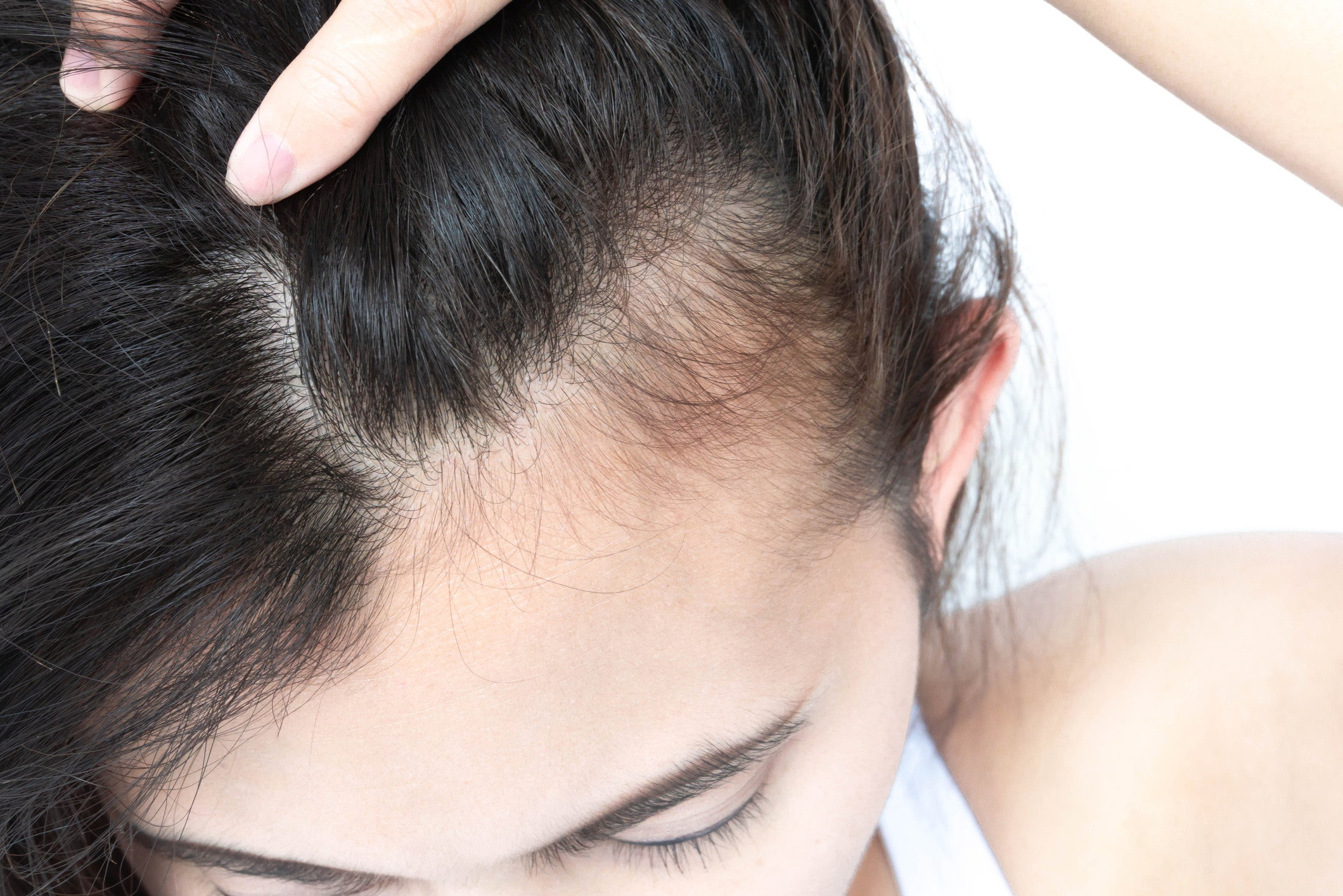 Po tej wcierce z bajkaliną i rumiankiem rzymskim mam prawdziwy wysyp baby hair! Zahamowała też wypadanie włosów