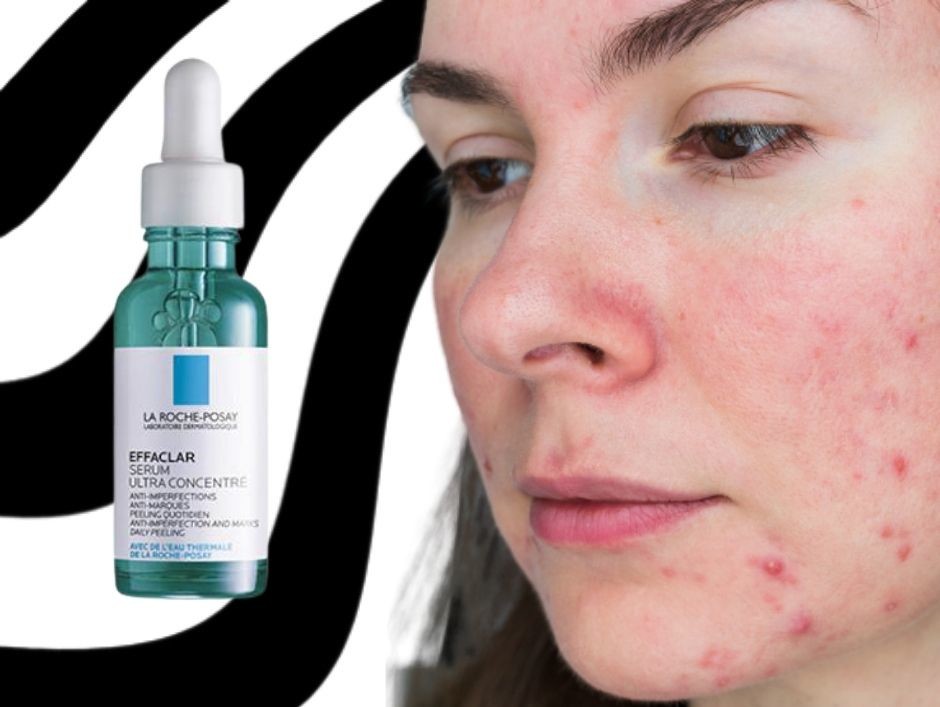 serum na niedoskonałości Effaclar La Roche Posay