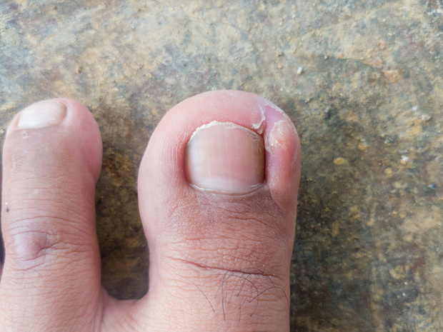 adult man thumb nails isolated on concrete floor