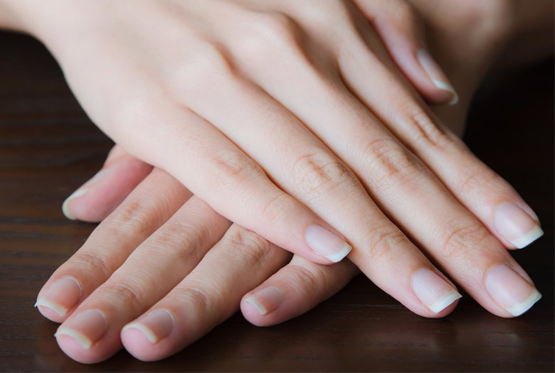łuszczyca paznokci przyczyny objawy leczenie manicure hybrydowy lakier do paznokci