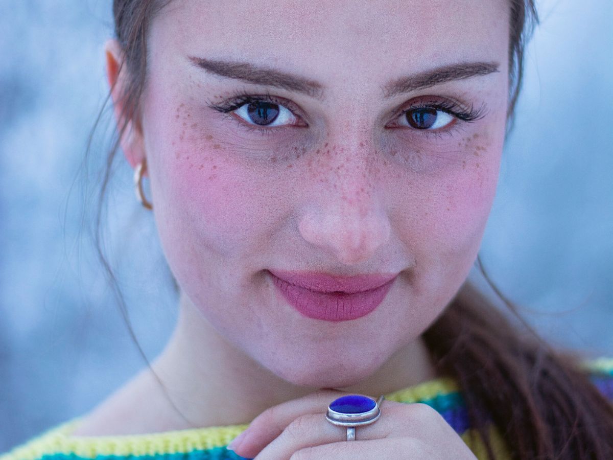skin icing