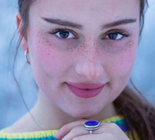 skin icing