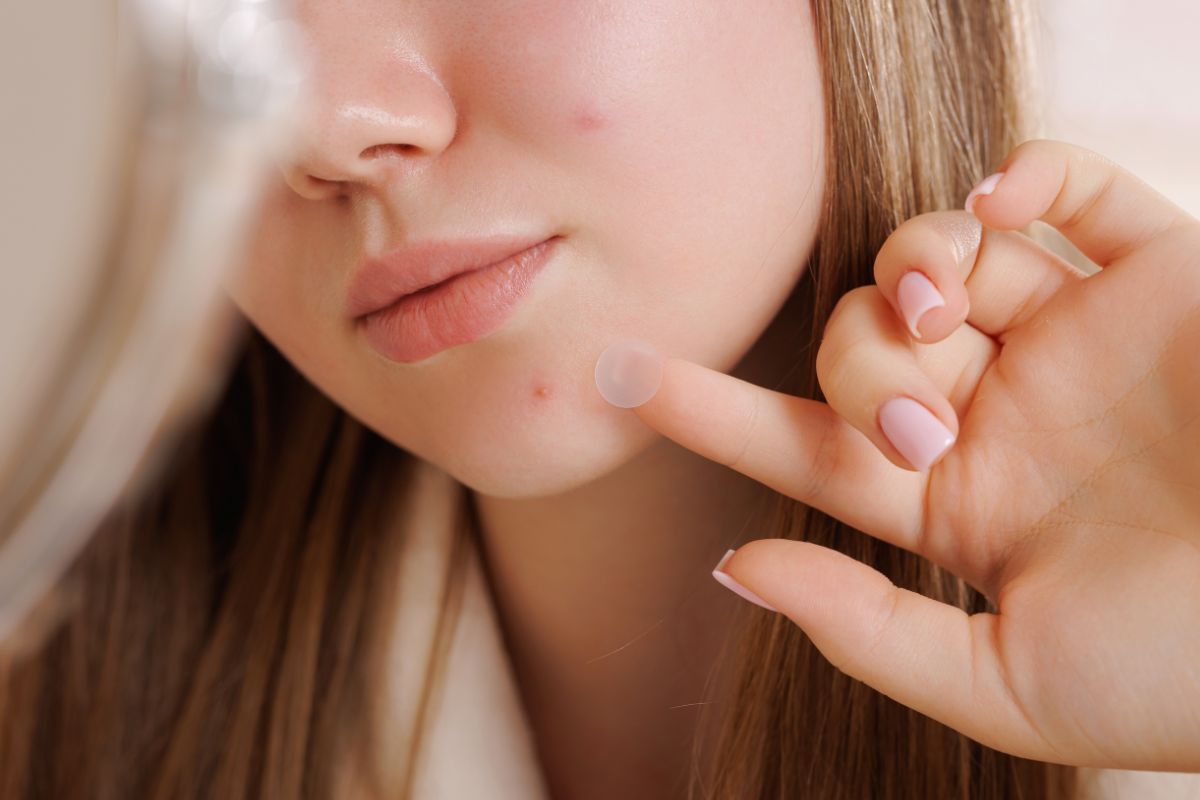 Viscoplast™ Acne Patch Plastry na zmiany trądzikowe