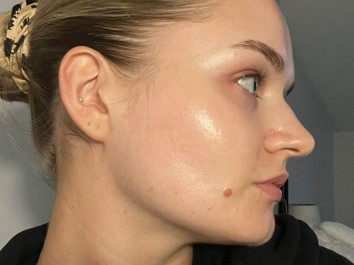 Użyłam bąbelkowego serum z kwasem hialuronowym, a twarz wygląda jak nasączona gąbka