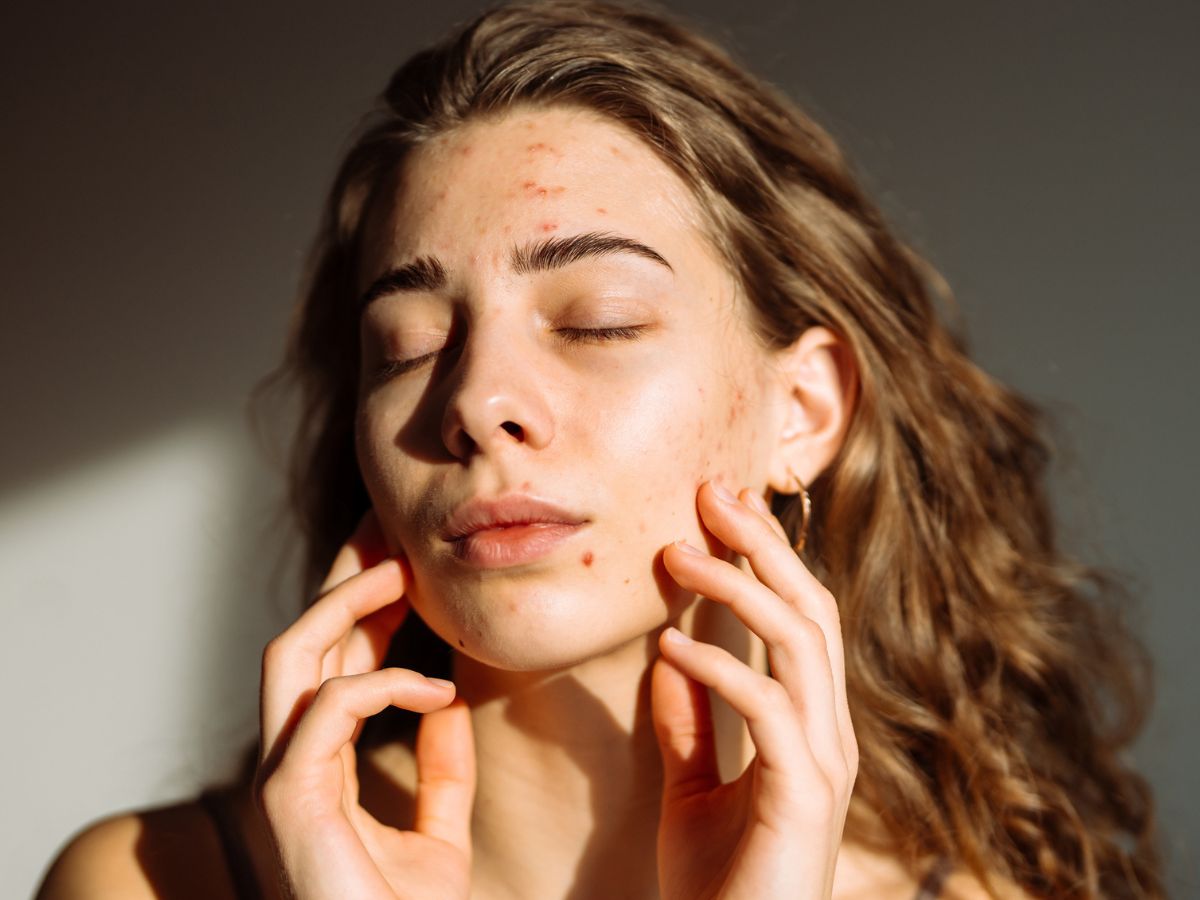 Sprawdziłam nową linię Bielenda Acne Remedium